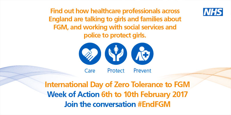 fgm